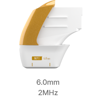 Ultraformer MPT Cartridge Detail